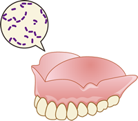 入れ歯の汚れについて